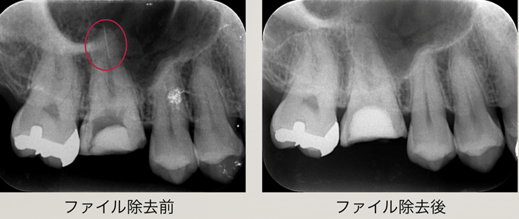 デジタル手術用顕微